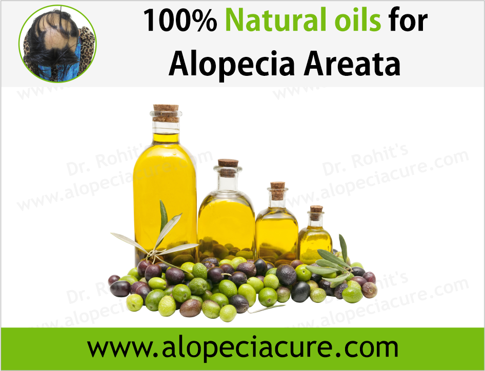 100% Natural oils for Alopecia Areata